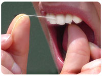 photo of proper flossing